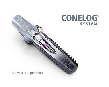 Conelog Camlog implantátumok